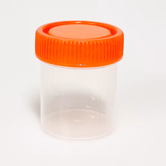 Contenitore per test con tazza di raccolta campioni di urina sotto vuoto sterile da 90 ml